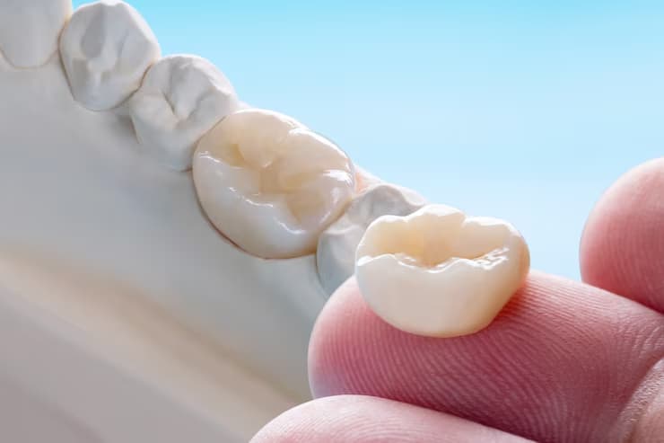 Dental Crown clinic